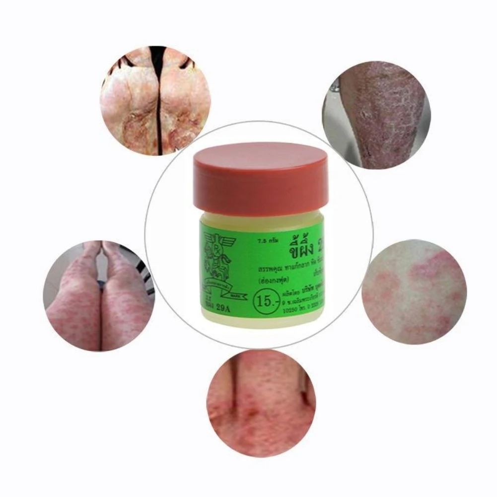 29A picazón Psoriasis Eczema crema Dermatitis tradicional Tailandia terapia ungüentos antibacterianos Cuerpo crema Dropship