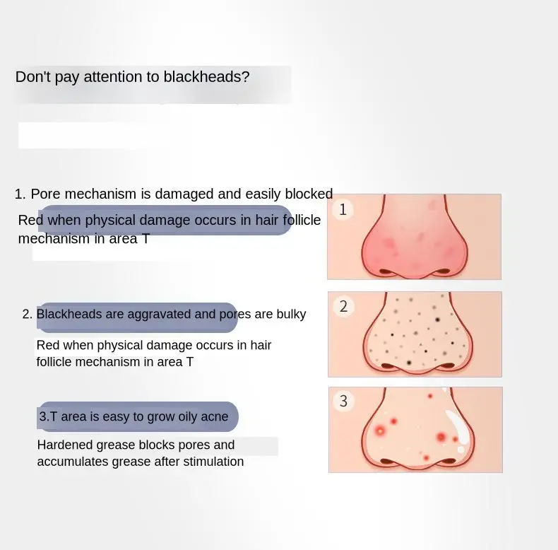 Removedor de Espinha Cravo Ferramenta Elétrica Microdermabrasion Acne Poros Cleaner Exfoliate Levantamento Empresa Beleza Equipamentos 9 Cheap Utensílios de cuidado facial
