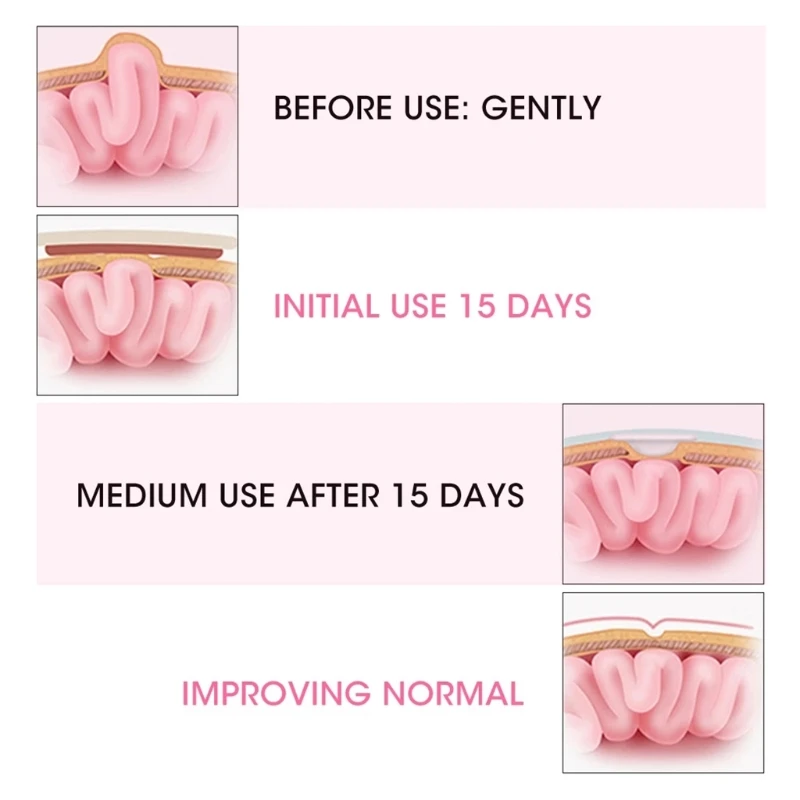 Umbilical Hernia Therapy Treatment Belt 2 Pcs/Box Breathable Bag Elastic Cotton Strap for 0-1 Years Old Baby Children Infant