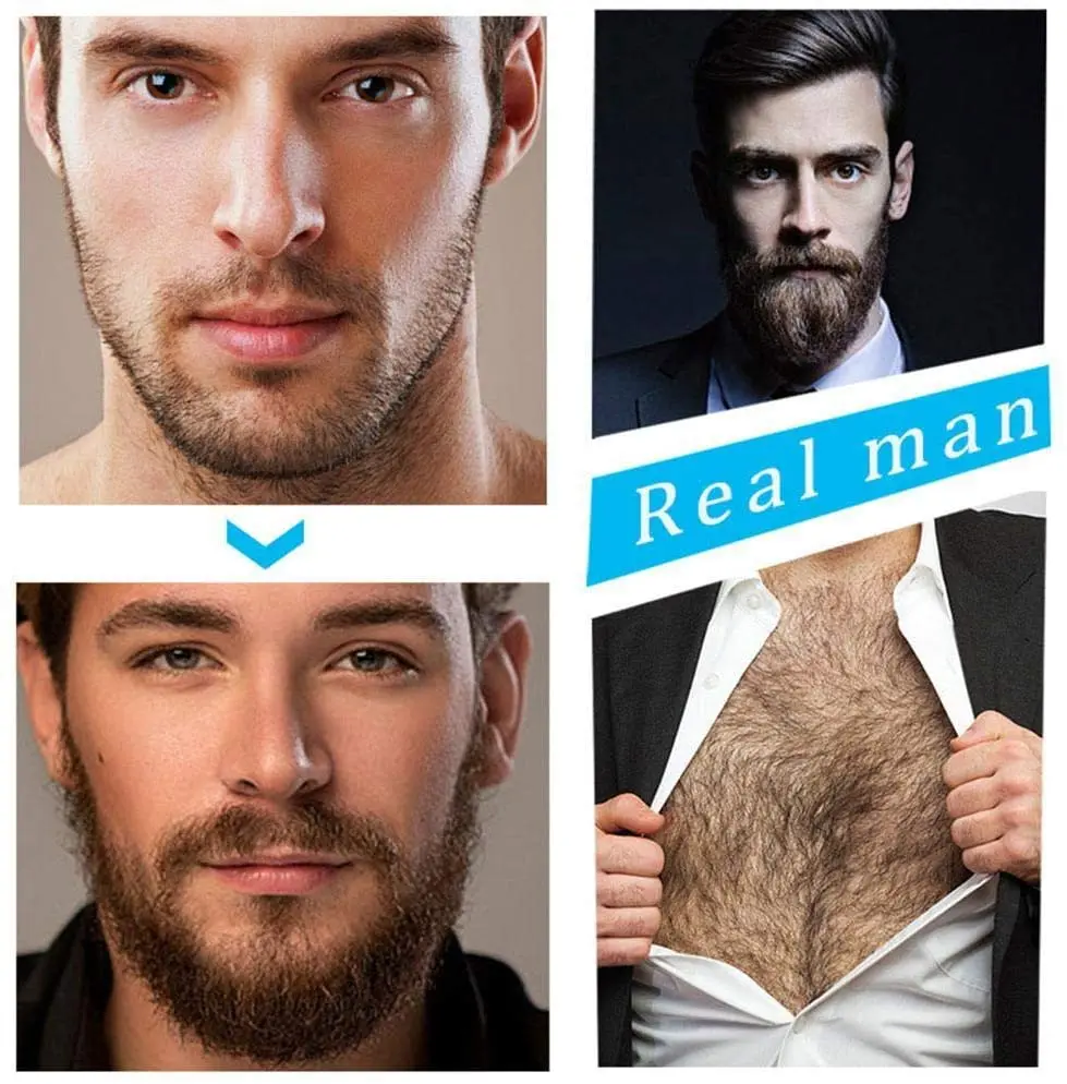 Beard Growth Oil Activator Serum Balm + Derma Pen Roller - Image 4