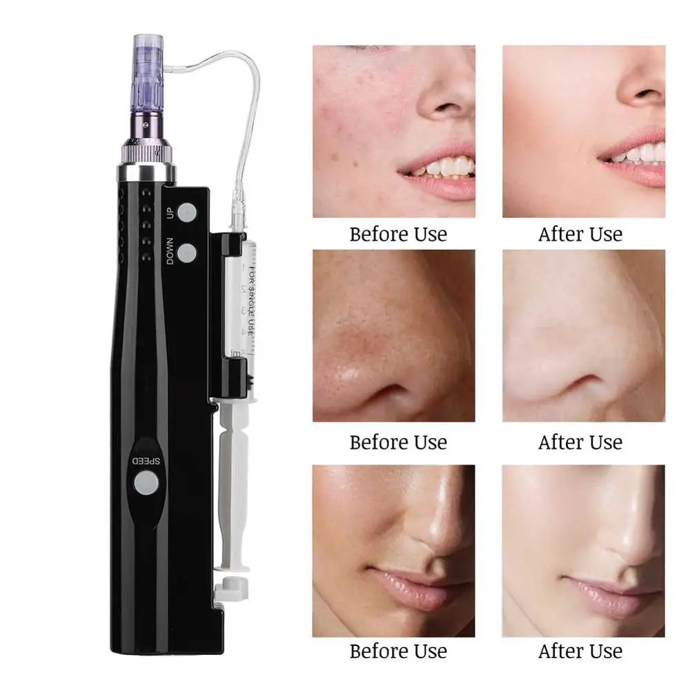 

Mini Electric Microblading Needle Instrument Water Light Introduction Whitening Freckle Wrinkle Skin Rejuvenation Beauty Machine