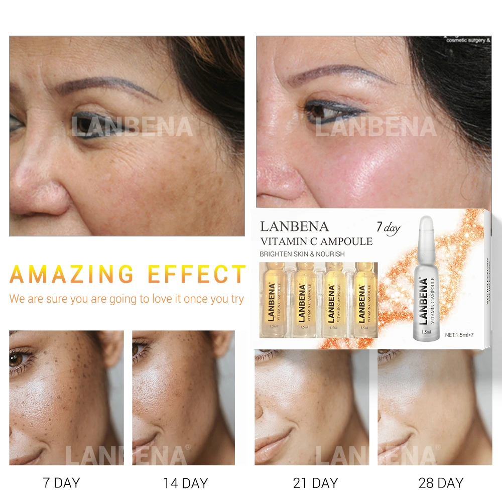 

LANBENA Vitamin C Ampoule Serum Whitening Remover Freckle Speckle Fade Dark Spots Moisturizing Anti-Aging Nourishing For 7 Days