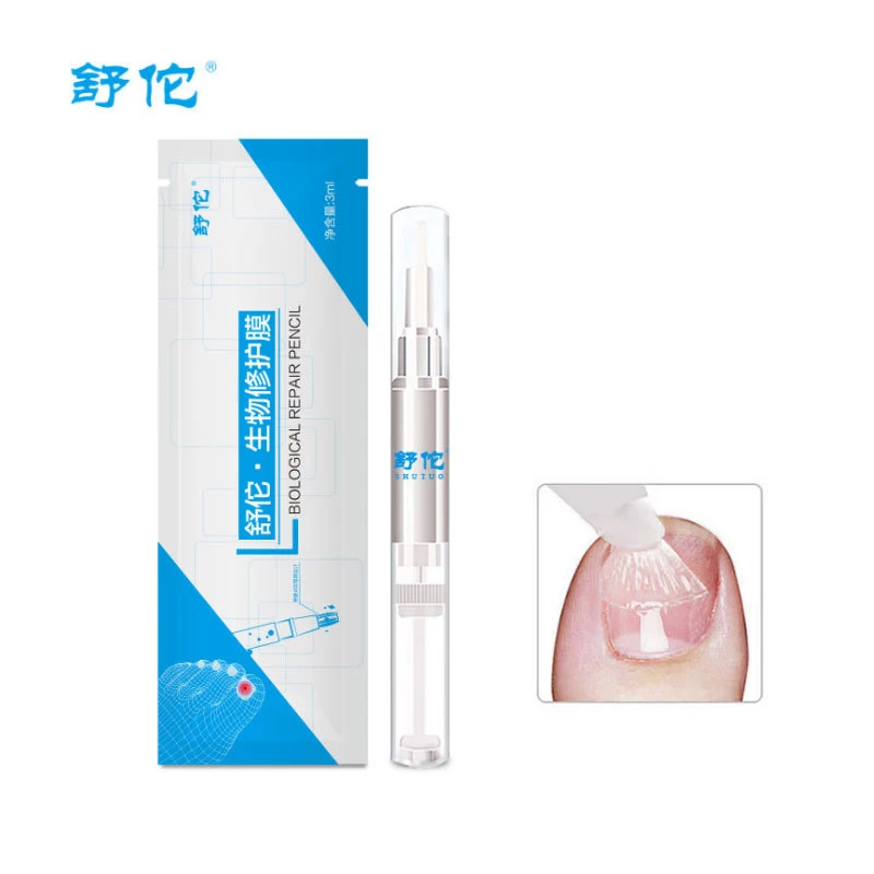 Anti Fungal Treatment Nail Pen Onychomycosis Paronychia Infection Herbal Toe Finger Nails Health Fungus Massage | Красота и здоровье