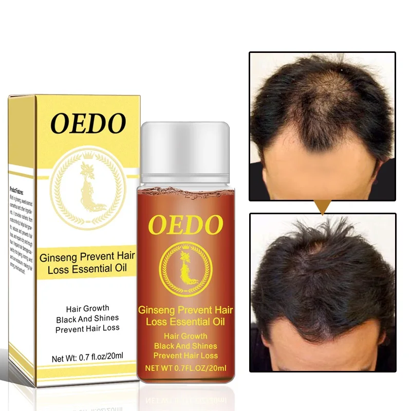 

Ginseng Hair Growth Essential Oils Essence Original Authentic Hair Loss Liquid Health Care Beauty Dense Hair Growth Serum TSLM1