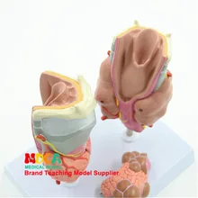 Гипертиреозм, гипотиреоз, эндокринная система человека, медицинское использование, анатомия, патологическая модель, обучение медицине Mhl003