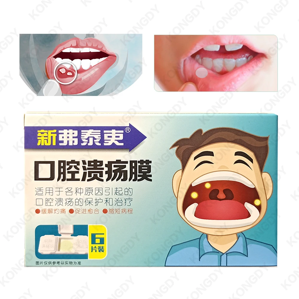 Oral Canker Sore Stickers Effective Mouth Ulcer Treatment Mouth Sole Cover Patch Fast Healing Safe Antibacterial Film 6PCS/BOX