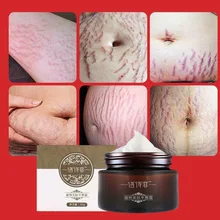 Натуральный Мягкий не раздражающий гинзенгстрейчевый крем для беременных мазь для лечения шрамов Растяжка живота растяжки крем для тела