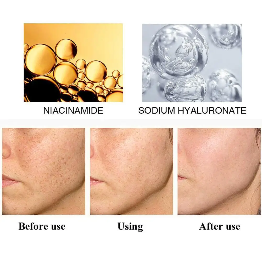 Отбеливание кожи спрей VC крем для лица Увлажняющий анти сыворотка Питательная