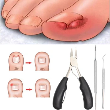 

3pcs Ingrown Thick Nail Stainless Steel Pedicure Hard Skin Remover Foot Care Catcher File Manual Toenail Clipper Set Long Handle