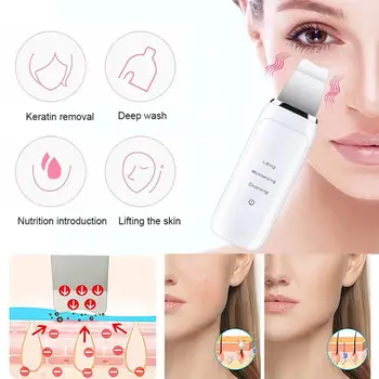 

Blackhead Removal Equipment Face Beauty Apparatus Black Head Cleaner ABS White Fashion Fast Effective Remove Clean Clear