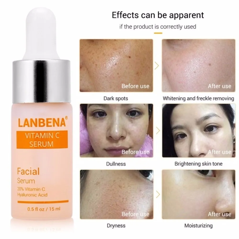 LANBENA Vitamin C Essence Skin Care Whitening Serum Hyaluronic Acid Face Cream Snail Remover Freckle Spots Anti-aging TSLM1 LANBENA Vitamin C Essence Skin Care Whitening Serum Hyaluronic Acid Face Cream Snail Remover Freckle Spots Anti-aging TSLM1