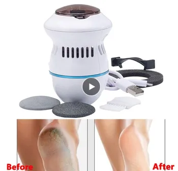 

Electric Foot File Vacuum Callus Remover Rechargeable Педикюр Clean Tools Feet Care For Hard Cracked Skin Files Pedicure
