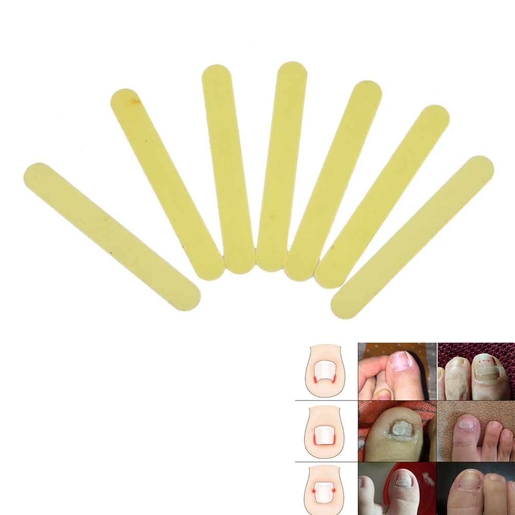 Вросший носок коррекция ногтей Наклейка патч для коррекции парониксии пилочка для ухода за ногами инструмент проволочный корректор желтый