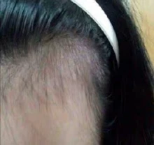 Sevich-espray de esencia para el crecimiento del cabello para hombres y mujeres, tratamiento para la pérdida del cabello, nutre las raíces, fácil de llevar, cuidado del cabello Germinal rápido, 30g