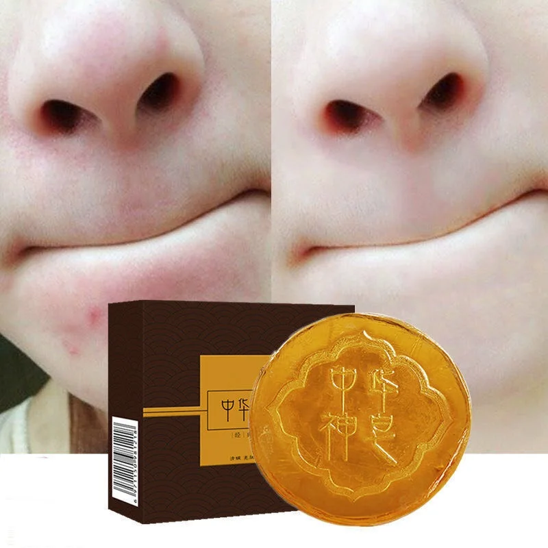 Hand Washing Chinese Soap Whitening Acne Control Oil Sulfur Hotel Soap Soap Pregnant Women Fruit Soap Bar Soap Melanin
