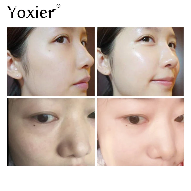 Yoxier 3 шт. Гиалуроновая кислота сыворотка улитки шесть пептидных концентратов
