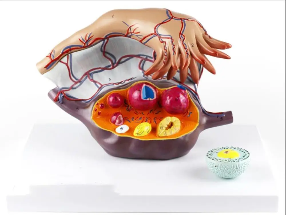 

Medical Anatomy Model of Female Enlarged Ovary Brand 35*24*24CM 120