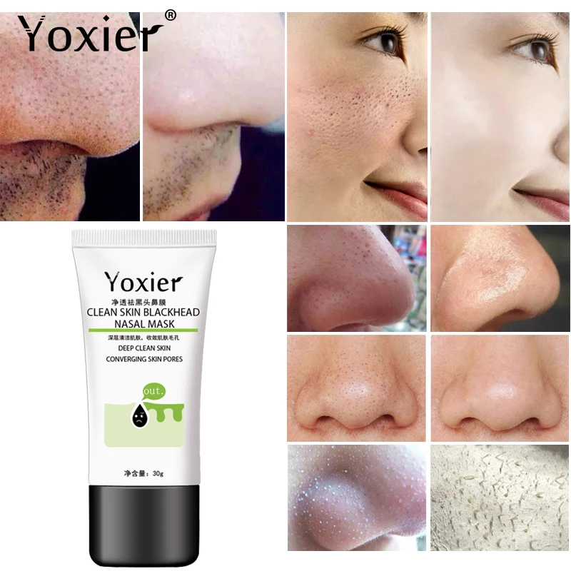 Yoxier Remove Blackhead Acne Nose Peeling Fabric Mask Skin Care Pore Strip Black Shill For Acne 1 Yoxier Remove Blackhead Acne Nose Peeling Fabric Mask Skin Care Pore Strip Black Shill For Acne 3