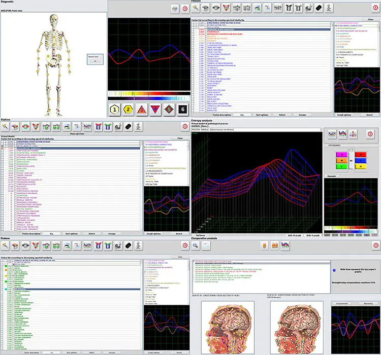 Body Magnetic Health  medical analyzer biochemistry for full body tests