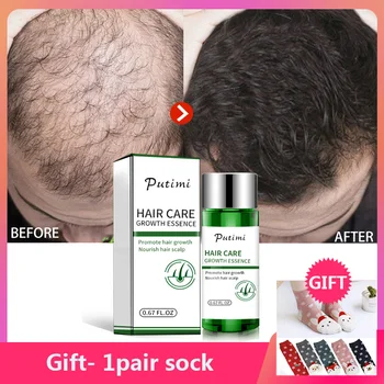 

20ml Hair Growth Serum Essence for Women and Men Anti Preventing Hair Loss Products Damaged Hair Repair Care Faster Growing