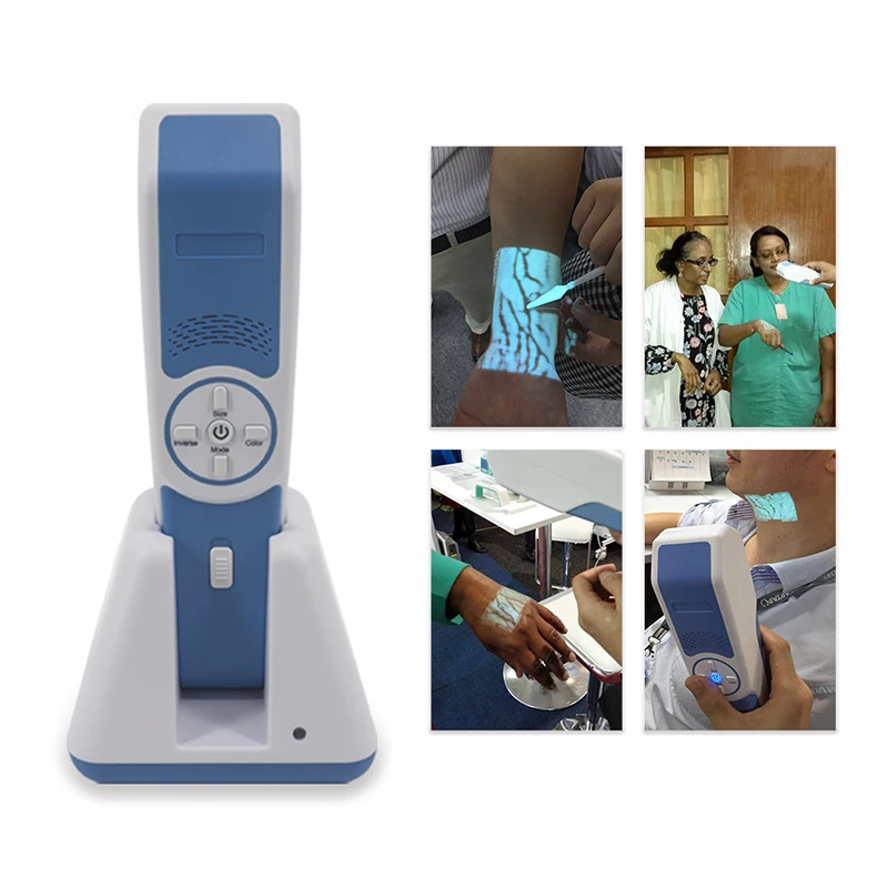 Больница Phlebotomy поиск трудных вен инфракрасная IV Детские вены просмотра цена