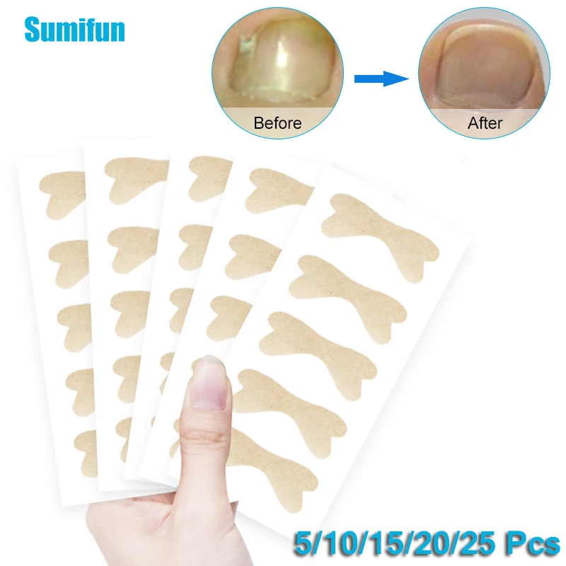 5/10/15/20/25 Pcs Toenail Corrector Toes Ingrown Nails Repair Stickers Nail Groove Curly Armor Correct Inflammatory Pain Relief