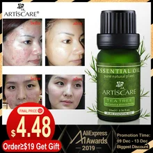 ARTISCARE чистое эфирное масло чайного дерева для средство по уходу за лицом от прыщей лечение масло для удаления черных точек против шрамов пятна массажное масло для лица