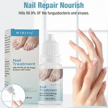 Горячая 10 мл жидкость для восстановления грибковых ногтей, удаление грибков для ногтей, Уход за ногтями