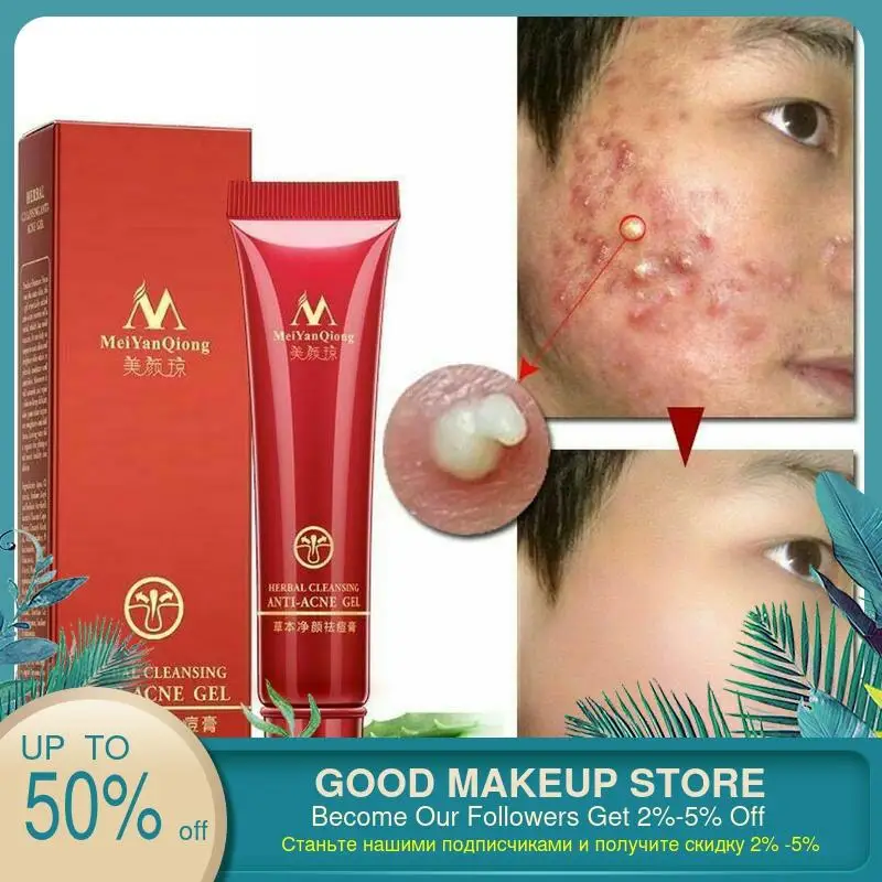 face clean cream for pimple