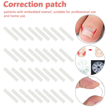 

Ingrown Toe Nail Feet Straightening Clip Nail Tip Sticker Brace Toe nails Thickness Correction Patch Foot Care Tools