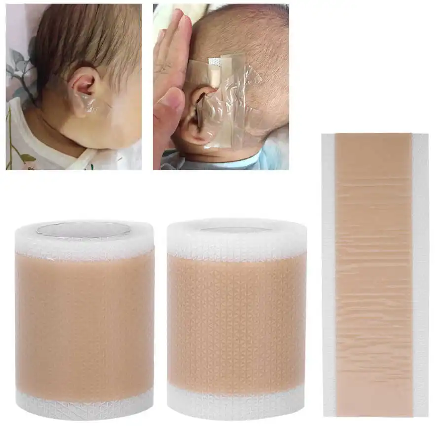 Description Picture 5 of itemSilicone Kids Infant Protruding Ear Patch Stickers Newborn Baby Ear Aesthetic Cosmetic Ear Corrector Ear Care Correction Tape