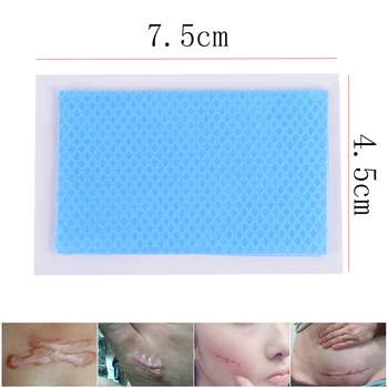 

4.5x7.5cm Silicone Gel Scar Sheet Removal Patch Reusable Acne Gel Scar Therapy Patch Remove Trauma Burn Sheet Skin Repair