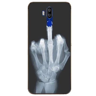 Для OUKITEL K9 чехол 7 12 дюйма Роскошный из ТПУ и силикона s для задняя крышка телефона