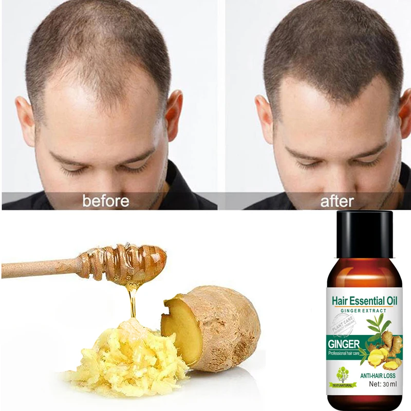 Mokeru 1pc 30ml Ginger Organic Herbal Hair Essential Oil Hair Loss Treatment Fast Growth oil For Women and man