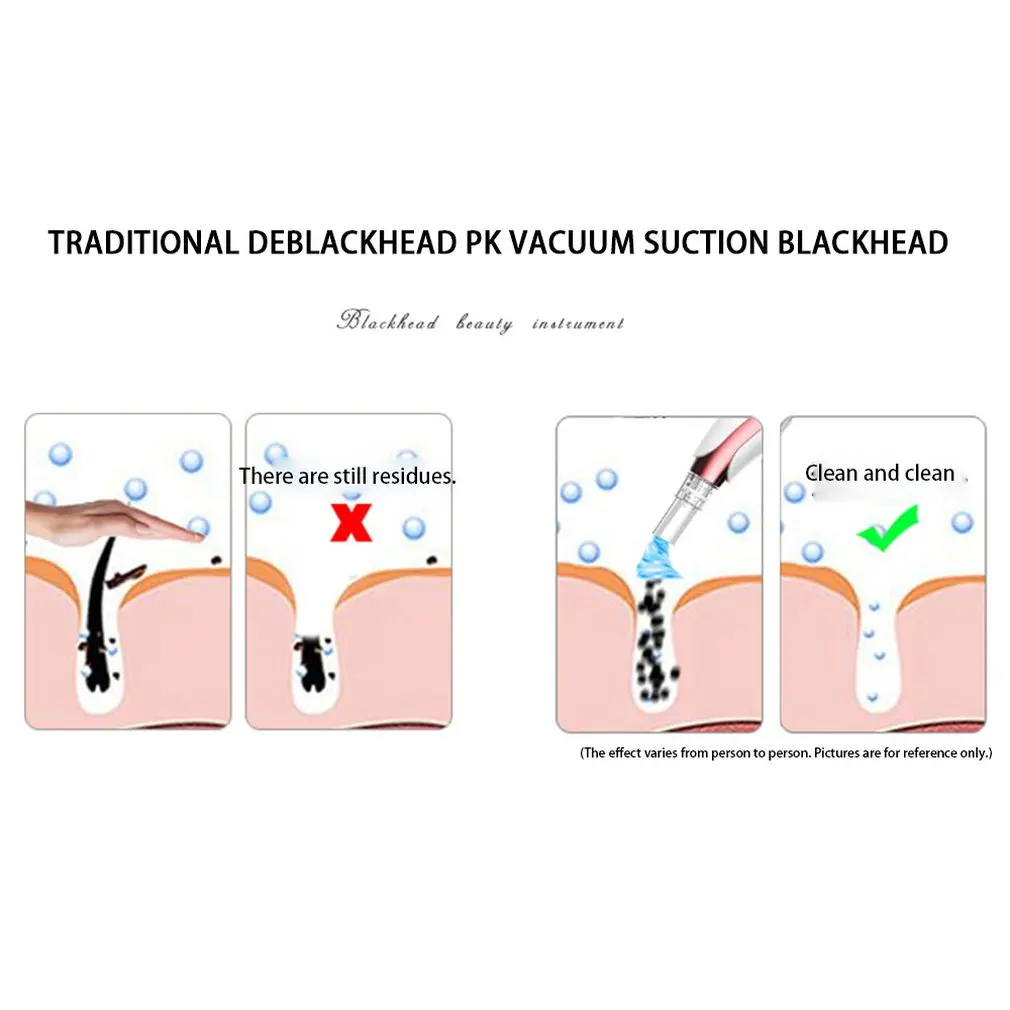 Exquisitely Designed Durable Charging Screen One Button Electric Blackhead Artifact Remove Pores Clean Facial Instruments 5