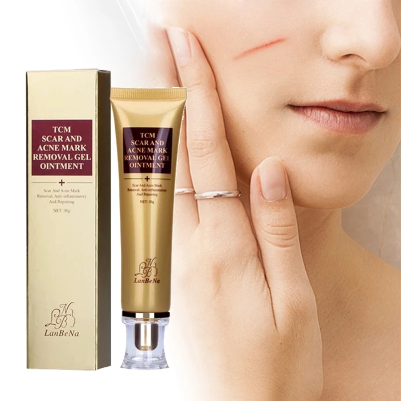 pimple and pimple marks removal cream