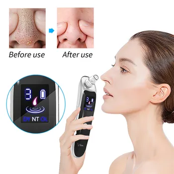 

Electric Blackhead Vacuum Acne Remover Blackhead Remover Face Pore Vacuum Skin Care Cleaner Pimple Removal Facial Tools#0629G40