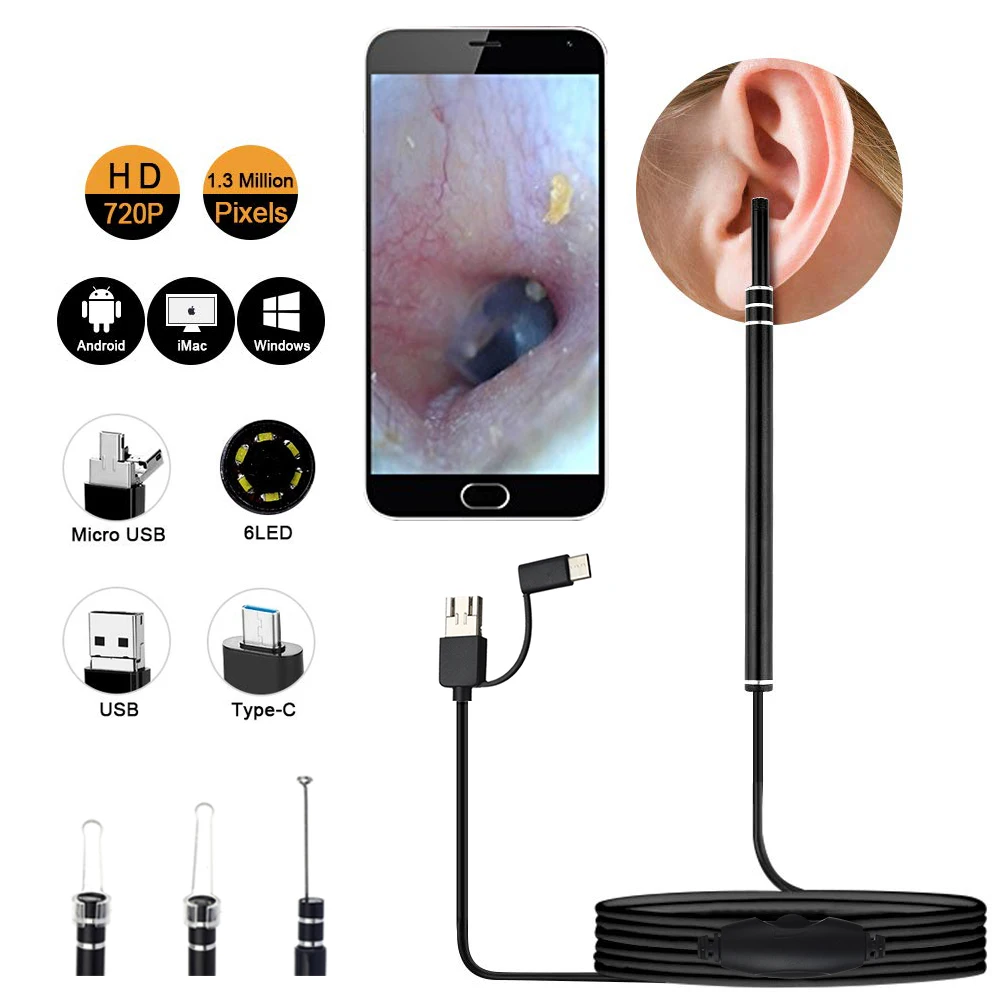 In Ear Cleaner Otoscopio Medico Ear Wax Removal Tool USB Type-C Plug HD Visual For Ear Cleaning Spoon Earpick Candle Endoscope