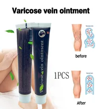 Крем для лечения варикозного расширения вен эффективное лечение васкулита, флебита, боли в венах, профессиональная варикозность, мазь от ангиита, здоровье