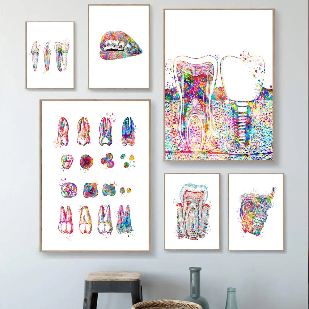 Tooth-Implant-Canvas-Wall-Painting-Dental-Art-Poster-Dentist-Anatomy-Prints-Medical-Wall-Art-Pictures-Hospital