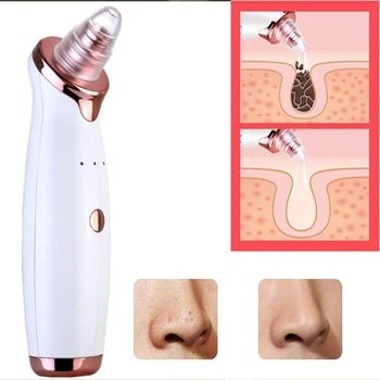

Facial Cleaner Pore Cleaner Blackhead Remover Vacuum Electric Nose Face Deep Cleansing Skin Care Machine Beauty Skin care tools