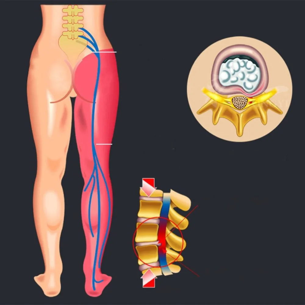 Многофункциональное растягивающее устройство регулируемая поза Корректор боли в спине