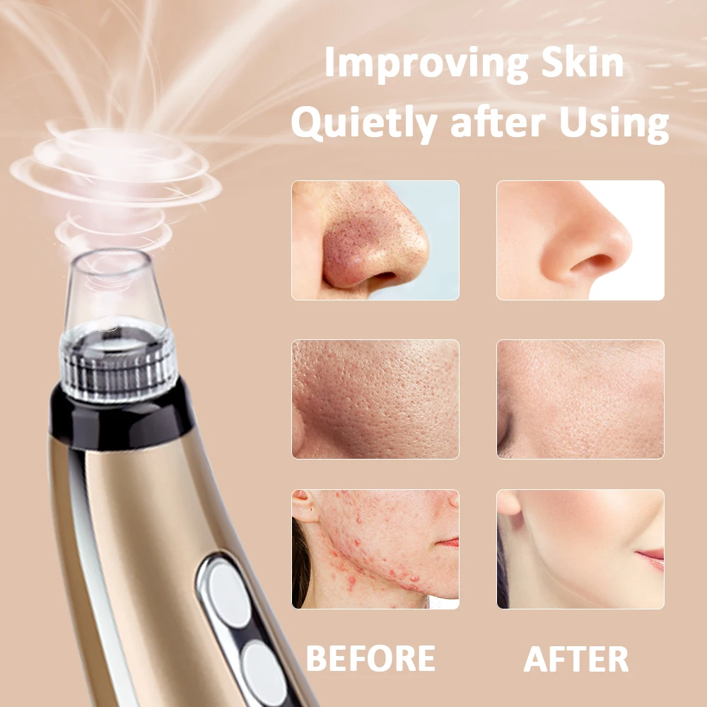 5 Suction Power Vacuum Blackhead Remover Pore Cleaner Acne Extractor Tool LCD Display Face Exfoliating Machine 3