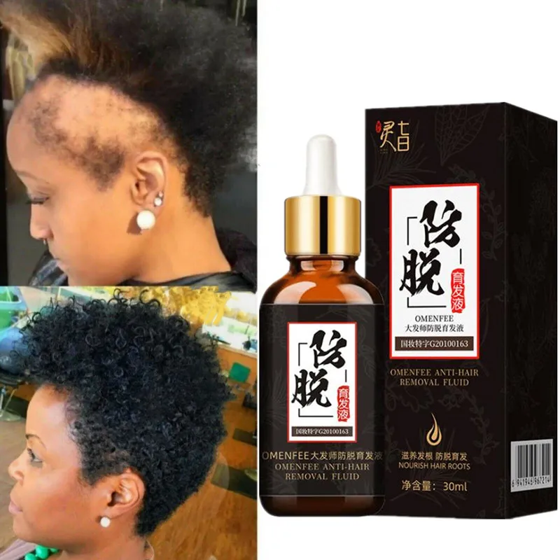Fast Wild Growth Hair Serum Oil Treatment for Loss Natural Essence Men Women EXTREME REPAIR For Bald Spots | Красота и здоровье