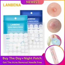 LANBENA дневной+ ночной удаления прыщей уход за кожей средство против прыщей Чай крем-основа содержит экстракт невидимые наклейки, для лечения прыщей, инструмент для удаления прыщей по уходу за кожей лица