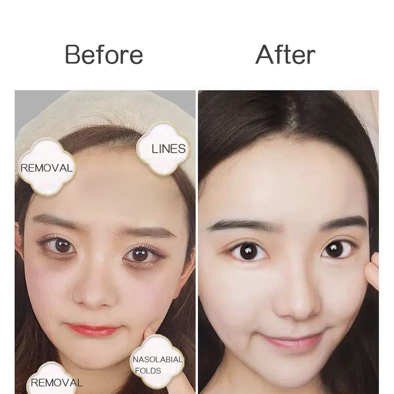 Eye Patches Hyaluronic Acids Microneedle Eye Pads Moisturizing Wrinkles Fine Lines Dark Circles Removal Collagen Eye Mask Patch