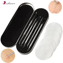 OSHIONER 5 шт. набор инструментов для удаления угрей из нержавеющей стали акне прыщи Комедон экстрактор точечный очиститель лица Уход за кожей защита