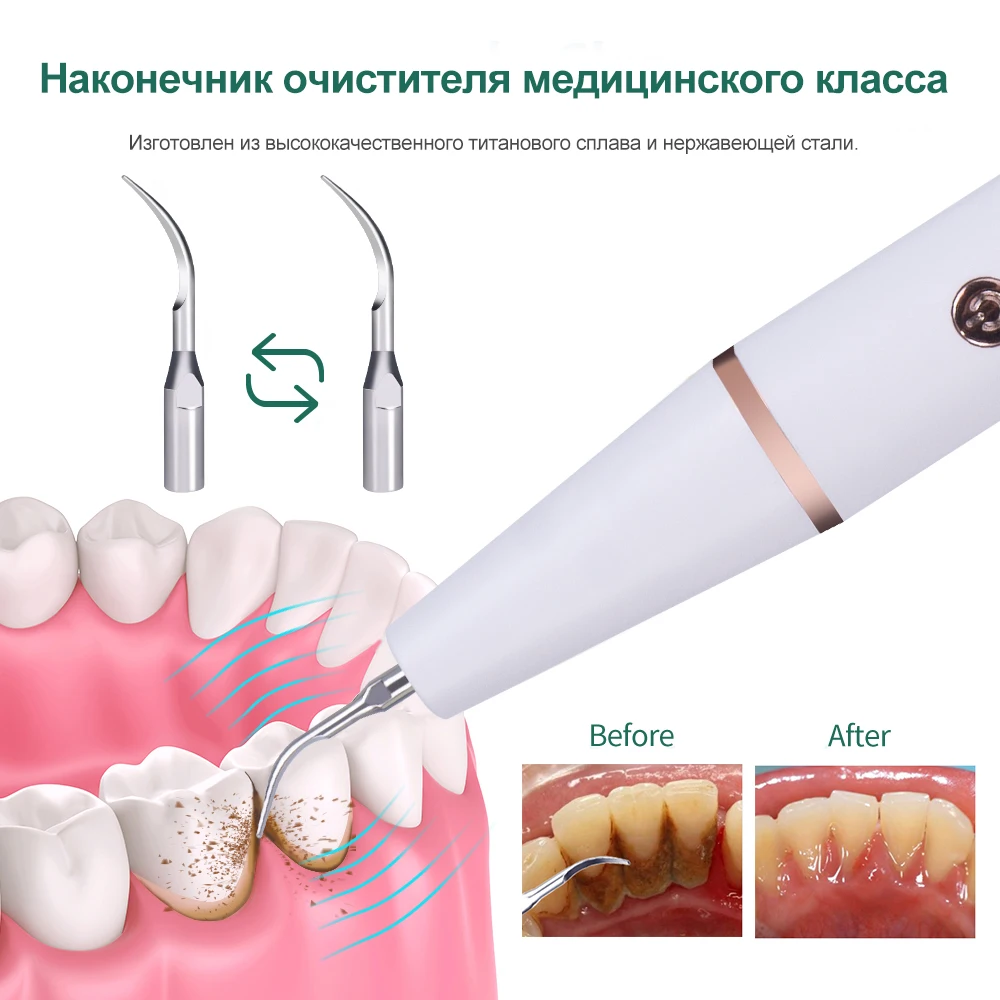 Как пользоваться зубным скалером. Стоматологические приспособления. Электрический звуковой стоматологический скалер. Oralgift ультразвуковой очиститель зубов. Как пользоваться зубным скалером.