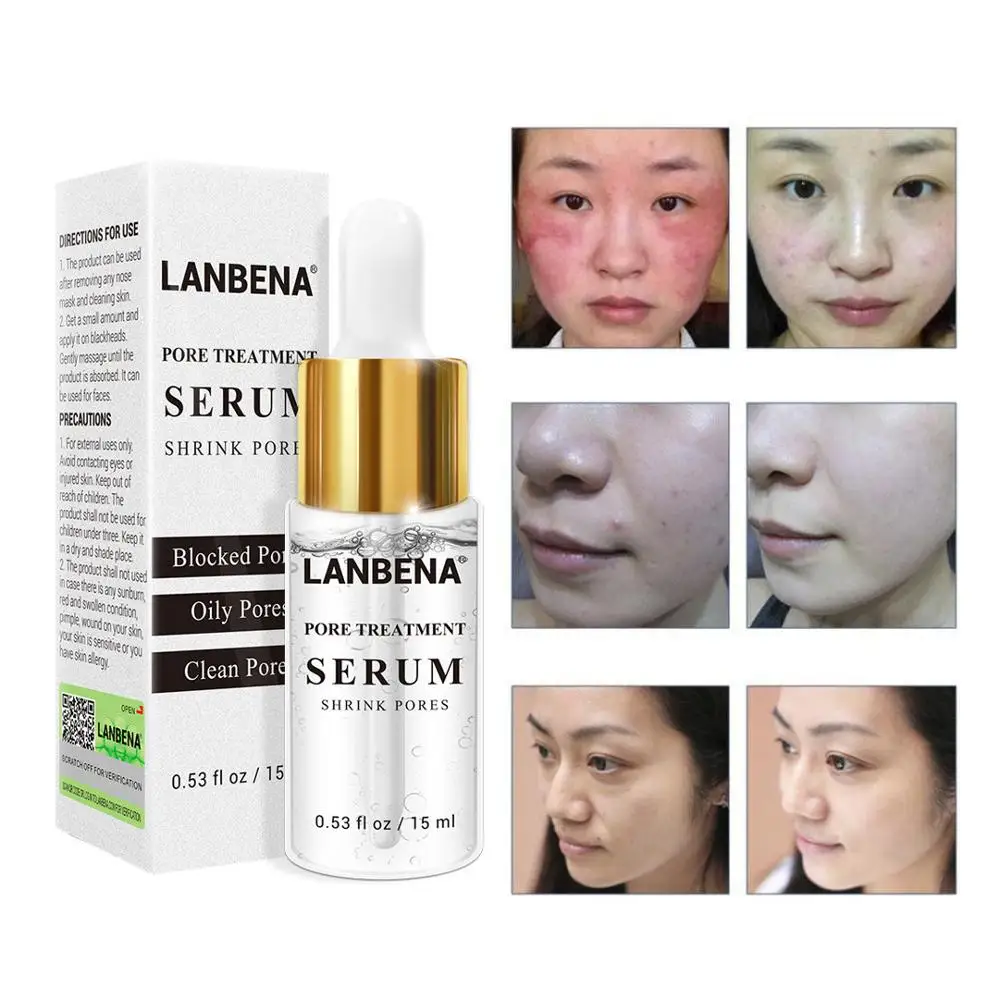 

Pore Refining Serum Shrink Pores Tightens Skin Care Essence Moisturizing Whitening Control Oil Facial Essence Anti-aging