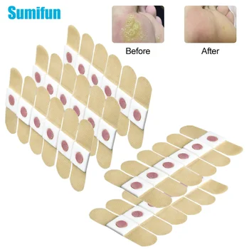 

6/36/60/80/120 Pieces Foot Care Foot Corn Removal Medical Plaster Calluses Plantar Warts Thorn For Relieving Pain Patch Stickers